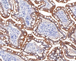 Invitrogen Villin Recombinant Rabbit Monoclonal Antibody (A2) 100 &mu;L | Buy Online | Invitrogen&trade; | Fisher Scientific