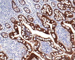 Invitrogen Villin Recombinant Rabbit Monoclonal Antibody (C4) 100 &mu;L;