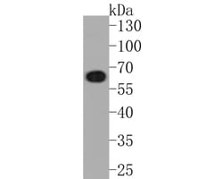 Invitrogen CoA Synthase Recombinant Rabbit Monoclonal Antibody (JE58-56)