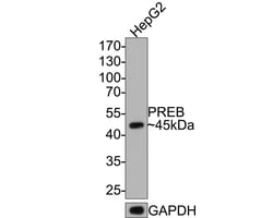 Invitrogen PREB Recombinant Rabbit Monoclonal Antibody (JE64-56) 100 &mu;L;
