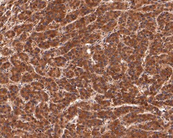 PEX11B Recombinant Rabbit Monoclonal Antibody (JE64-51):Antibodies, Recombinant
