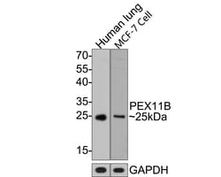 PEX11B Recombinant Rabbit Monoclonal Antibody (JE64-51):Antibodies, Recombinant