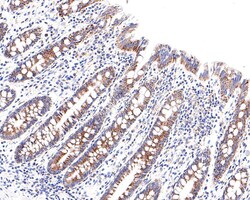 Invitrogen CECR5 Recombinant Rabbit Monoclonal Antibody (JE64-76) 100 &mu;L;