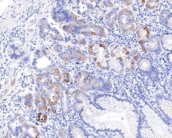 Invitrogen CECR5 Recombinant Rabbit Monoclonal Antibody (JE64-76) 100 &mu;L;
