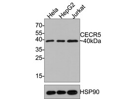 Invitrogen CECR5 Recombinant Rabbit Monoclonal Antibody (JE64-76) 100 &mu;L;