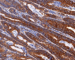 Invitrogen MYO1B Recombinant Rabbit Monoclonal Antibody (JE65-01) 100 &mu;L;