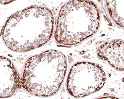 Invitrogen MYO1B Recombinant Rabbit Monoclonal Antibody (JE65-01) 100 &mu;L;