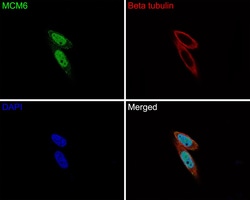 Invitrogen MCM6 Recombinant Rabbit Monoclonal Antibody (JE65-68) 100 &mu;L;