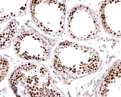 Invitrogen MCM6 Recombinant Rabbit Monoclonal Antibody (JE65-68) 100 &mu;L;
