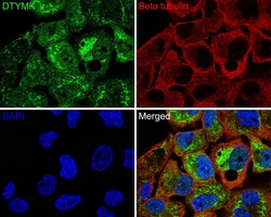 Invitrogen DTYMK Recombinant Rabbit Monoclonal Antibody (JE64-08) 100 μL;