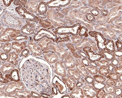 Invitrogen DTYMK Recombinant Rabbit Monoclonal Antibody (JE64-08) 100 μL;