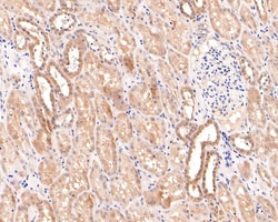 Invitrogen PCBP2 Recombinant Rabbit Monoclonal Antibody (JE65-05) 100 &mu;L;