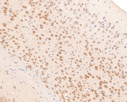 Invitrogen PCBP2 Recombinant Rabbit Monoclonal Antibody (JE65-05) 100 &mu;L;