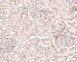 Invitrogen NTHL1 Recombinant Rabbit Monoclonal Antibody (JE65-02) 100 &mu;L;