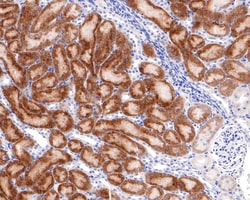 Invitrogen TMEM192 Recombinant Rabbit Monoclonal Antibody (JE64-89) 100 &mu;L | Buy Online | Invitrogen&trade; | Fisher Scientific