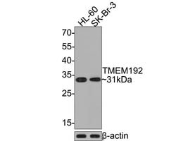 Invitrogen TMEM192 Recombinant Rabbit Monoclonal Antibody (JE64-89) 100 &mu;L | Buy Online | Invitrogen&trade; | Fisher Scientific