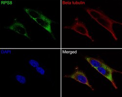 Invitrogen RPS8 Recombinant Rabbit Monoclonal Antibody (JE65-57) 100 &mu;L;