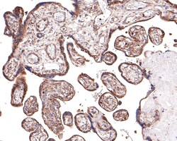 Invitrogen RPS8 Recombinant Rabbit Monoclonal Antibody (JE65-57) 100 &mu;L;