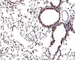 Invitrogen RPS8 Recombinant Rabbit Monoclonal Antibody (JE65-57) 100 &mu;L;