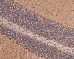 Invitrogen RPS8 Recombinant Rabbit Monoclonal Antibody (JE65-57) 100 &mu;L;