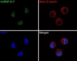 Invitrogen RBMXL2 Recombinant Rabbit Monoclonal Antibody (JE64-33) 100