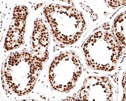 Invitrogen RBMXL2 Recombinant Rabbit Monoclonal Antibody (JE64-33) 100