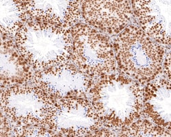 Invitrogen RBMXL2 Recombinant Rabbit Monoclonal Antibody (JE64-33) 100