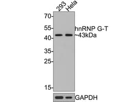 Invitrogen RBMXL2 Recombinant Rabbit Monoclonal Antibody (JE64-33) 100