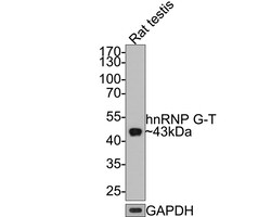 Invitrogen RBMXL2 Recombinant Rabbit Monoclonal Antibody (JE64-33) 100