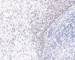 Invitrogen RAVER2 Recombinant Rabbit Monoclonal Antibody (JE64-36) 100