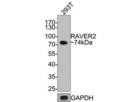 Invitrogen RAVER2 Recombinant Rabbit Monoclonal Antibody (JE64-36) 100
