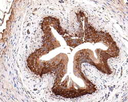 Invitrogen RPL10A Recombinant Rabbit Monoclonal Antibody (JE64-41) 100