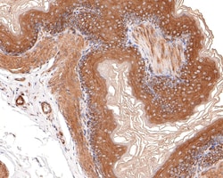Invitrogen CYFIP1 Recombinant Rabbit Monoclonal Antibody (JE64-11) 100