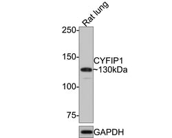 Invitrogen CYFIP1 Recombinant Rabbit Monoclonal Antibody (JE64-11) 100