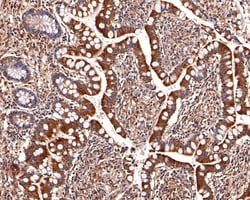 Invitrogen MST4 Recombinant Rabbit Monoclonal Antibody (JE64-64) 100 &mu;L;