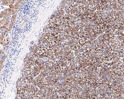 Invitrogen ACAT1 Recombinant Rabbit Monoclonal Antibody (JE64-40) 100 &mu;L;