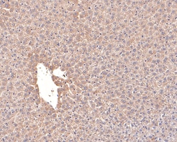 Invitrogen ACAT1 Recombinant Rabbit Monoclonal Antibody (JE64-40) 100 &mu;L;