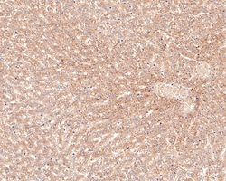 Invitrogen ACAT1 Recombinant Rabbit Monoclonal Antibody (JE64-40) 100 &mu;L;