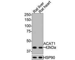 Invitrogen ACAT1 Recombinant Rabbit Monoclonal Antibody (JE64-40) 100 &mu;L;