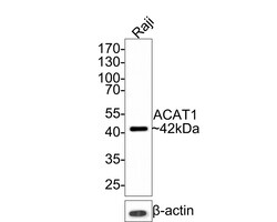 Invitrogen ACAT1 Recombinant Rabbit Monoclonal Antibody (JE64-40) 100 &mu;L;