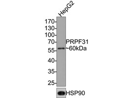 Invitrogen PRPF31 Recombinant Rabbit Monoclonal Antibody (JE64-82) 100 &mu;L | Buy Online | Invitrogen&trade; | Fisher Scientific