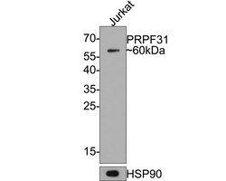 Invitrogen PRPF31 Recombinant Rabbit Monoclonal Antibody (JE64-82) 100 &mu;L | Buy Online | Invitrogen&trade; | Fisher Scientific