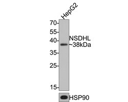Invitrogen NSDHL Recombinant Rabbit Monoclonal Antibody (JE64-86) 100 &mu;L;