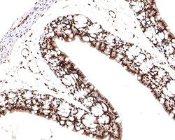 Invitrogen TCEA1 Recombinant Rabbit Monoclonal Antibody (JE64-90) 100 &mu;L;