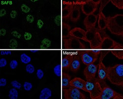 Invitrogen SAFB Recombinant Rabbit Monoclonal Antibody (JE64-94) 100 &mu;L;