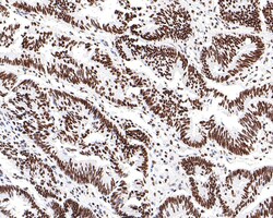 Invitrogen SAFB Recombinant Rabbit Monoclonal Antibody (JE64-94) 100 &mu;L;