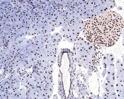Invitrogen SAFB Recombinant Rabbit Monoclonal Antibody (JE64-94) 100 &mu;L;