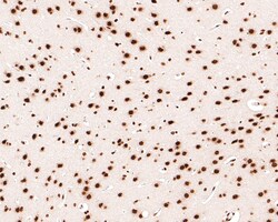 Invitrogen SAFB Recombinant Rabbit Monoclonal Antibody (JE64-94) 100 &mu;L;