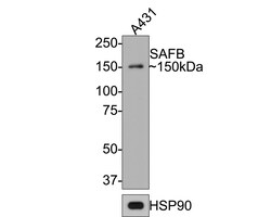 Invitrogen SAFB Recombinant Rabbit Monoclonal Antibody (JE64-94) 100 &mu;L;