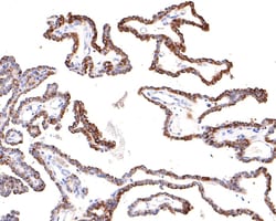 Invitrogen SNX5 Recombinant Rabbit Monoclonal Antibody (JE64-96) 100 &mu;L;